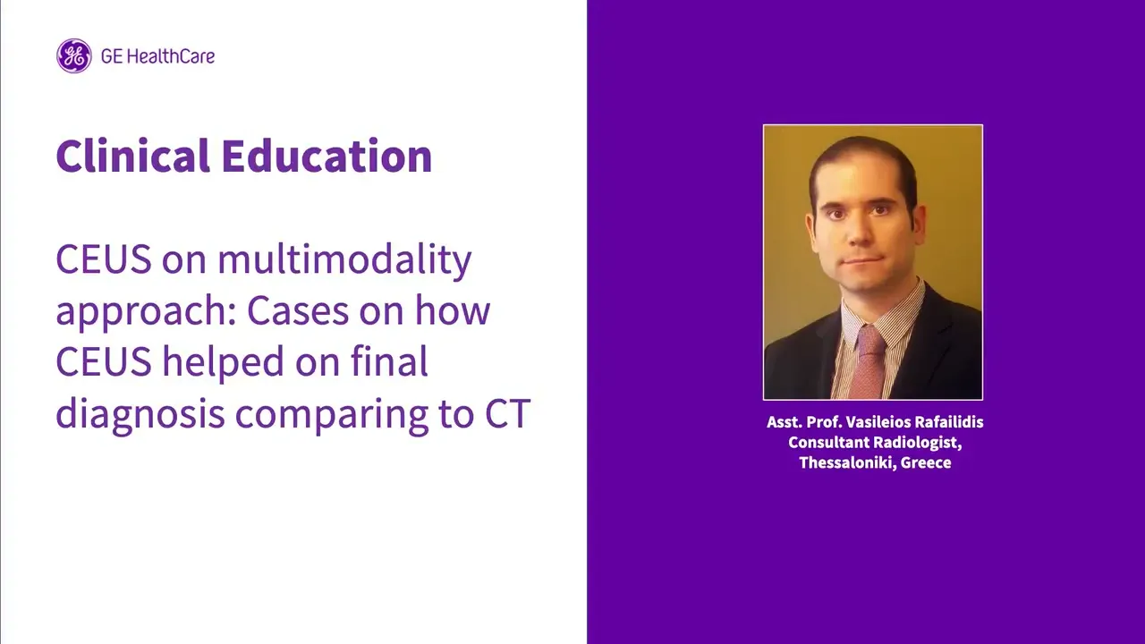 Asst  Prof  Vasileios Rafailidis Consultant Radiologist
