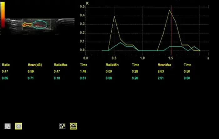 2D Flow quantification assessment with PDI