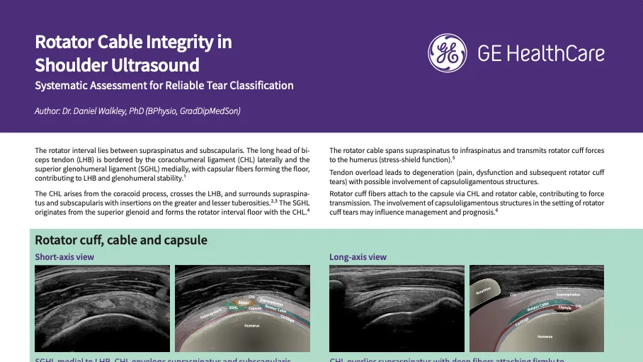 Rotator Cable Integrity in Shoulder Ultrasound 
