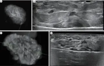 ABUS Specimen scanning