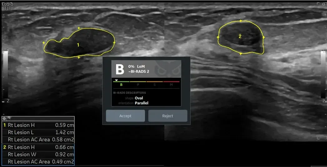 Koios DS™ support diagnosis tool ‍