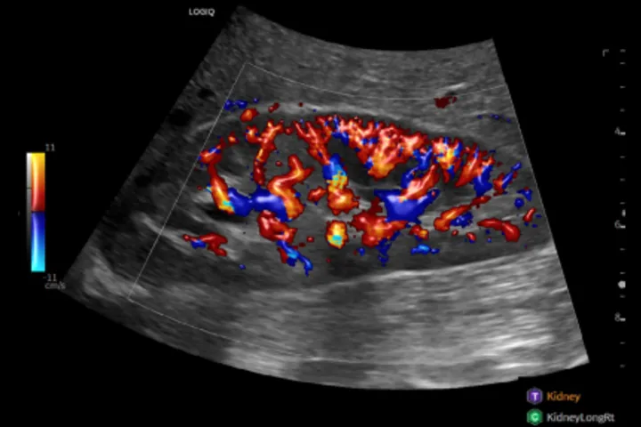 How Artificial Intelligence Enhances Ultrasound in Clinical Practice