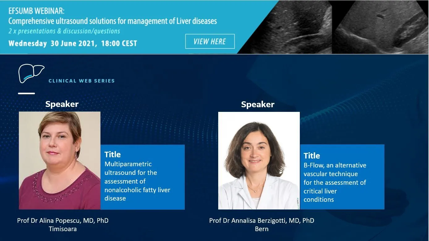 Chapter 2 B Flow, an alternative vascular technique for the assessment of critical liver conditions