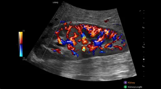 How Artificial Intelligence Enhances Ultrasound in Clinical Practice