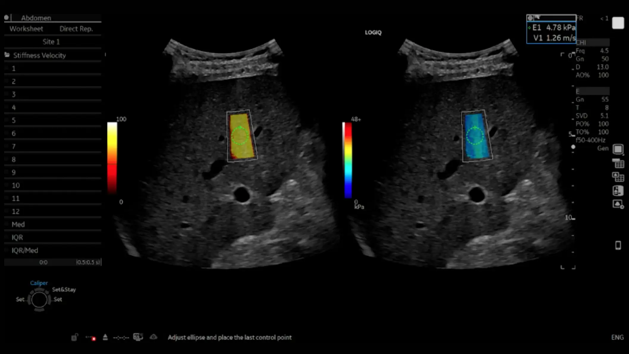 Liver video screen 2