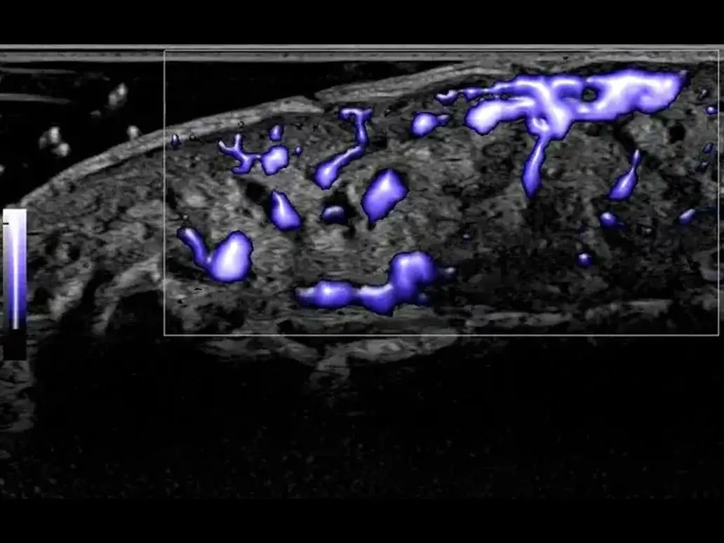 Msk early vascular evaluation with flow modes